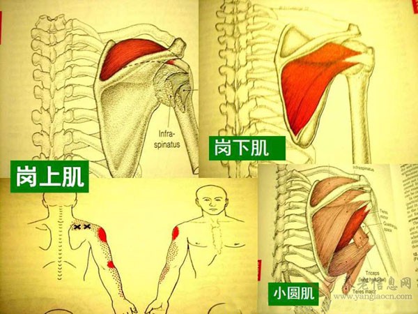 姿勢(shì)不良、用力不當(dāng)、營(yíng)養(yǎng)不均都是肌筋膜疼痛的病因