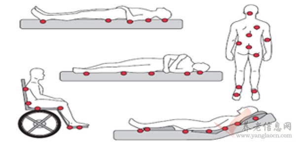 壓瘡好發(fā)的部位?