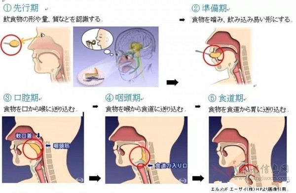 婷婷講介護 | 飲食介護相關的身心技能以及護理常識